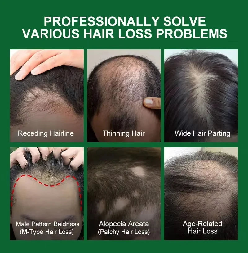 Anti Hair Loss Fast Hair Growth Serum Spray - Petti’s Natural Boutique