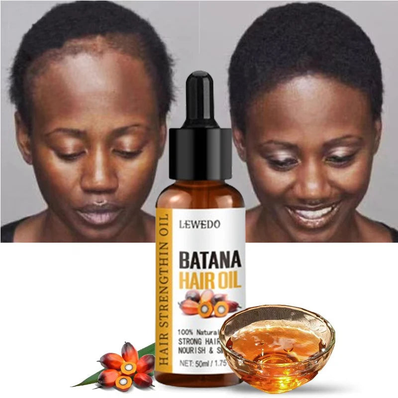 Naturals Batana Oil Fast Hair Growth - Petti’s Natural Boutique