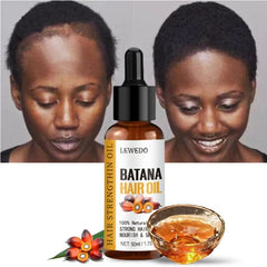 Naturals Batana Oil Fast Hair Growth - Petti’s Natural Boutique