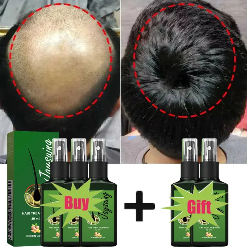 Anti Hair Loss Fast Hair Growth Serum Spray - Petti’s Natural Boutique