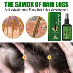 Anti Hair Loss Fast Hair Growth Serum Spray - Petti’s Natural Boutique