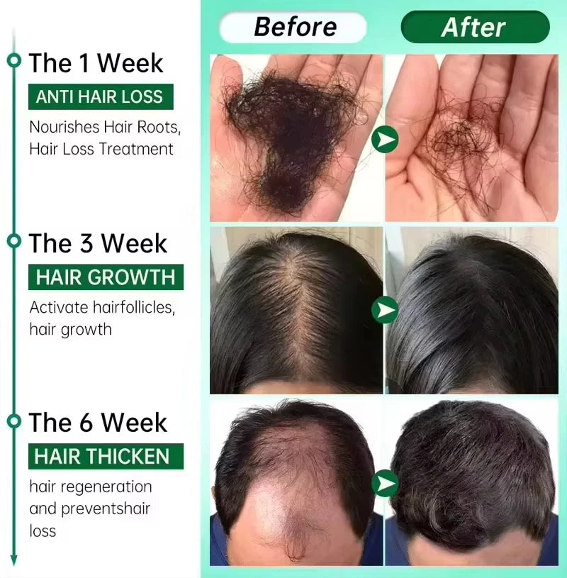 Anti Hair Loss Fast Hair Growth Serum Spray - Petti’s Natural Boutique