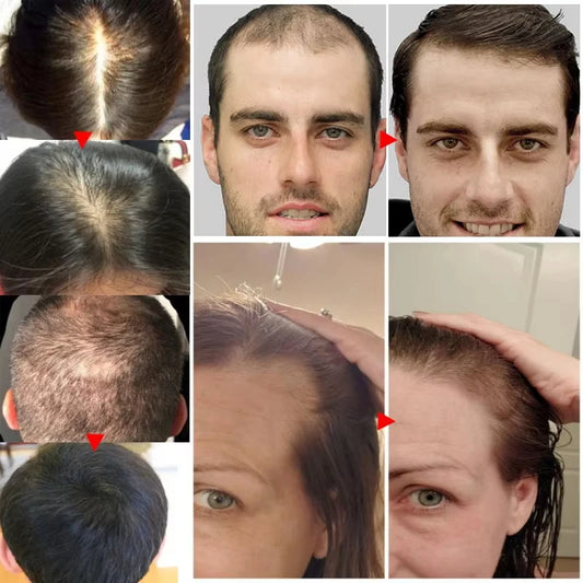 Anti Hair Loss Fast Hair Growth Serum Spray - Petti’s Natural Boutique