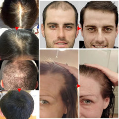 Anti Hair Loss Fast Hair Growth Serum Spray - Petti’s Natural Boutique